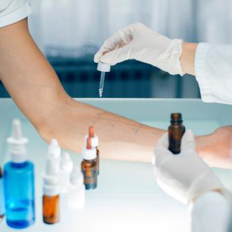 Allergietest auf Arm des Patienten