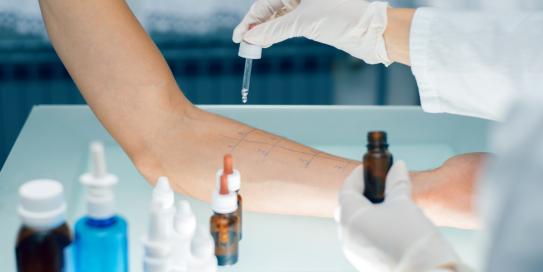 Allergietest auf Arm des Patienten
